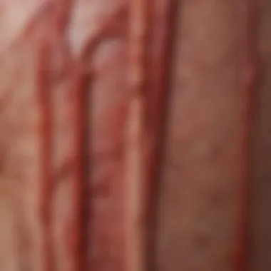 Close-up of fragile blood vessels in aging skin