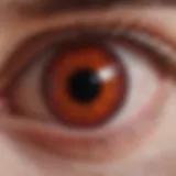 Close-up view of a red eye indicating conjunctivitis