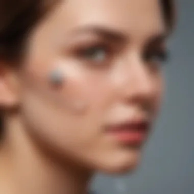 Experiences with the Nexplanon Implant Nexplanon implant user experiences