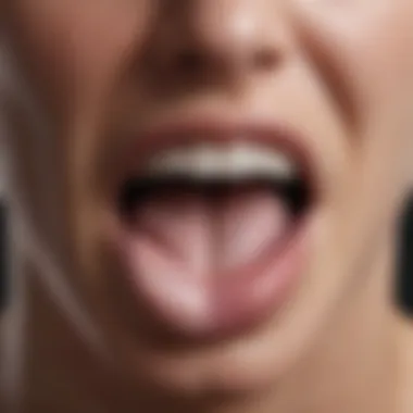 Close-up view of a white-coated tongue